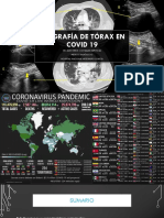 Ecografía de Tórax en La COVID-19
