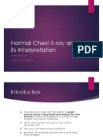 Chest Xray