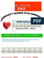EKG analysis guide
