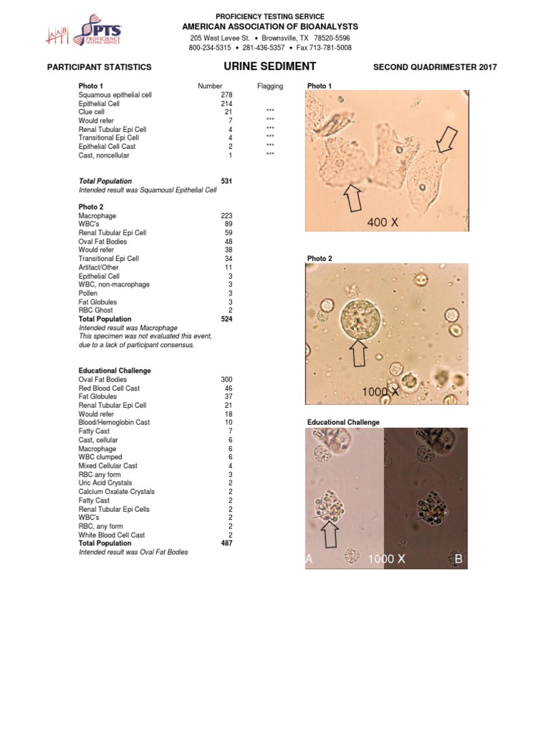 Chem Urinalysis Urine Sediment 2Q2017 PDF Red Blood Cell Kidney