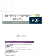 Ureteric Stricture
