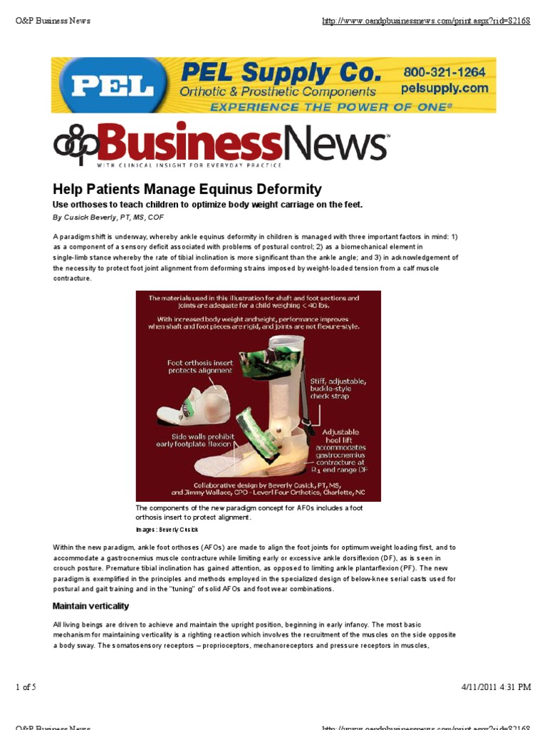 Help Patients Manage Equinus Deformity Foot Musculoskeletal System