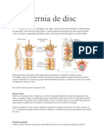 Hernia de Disc