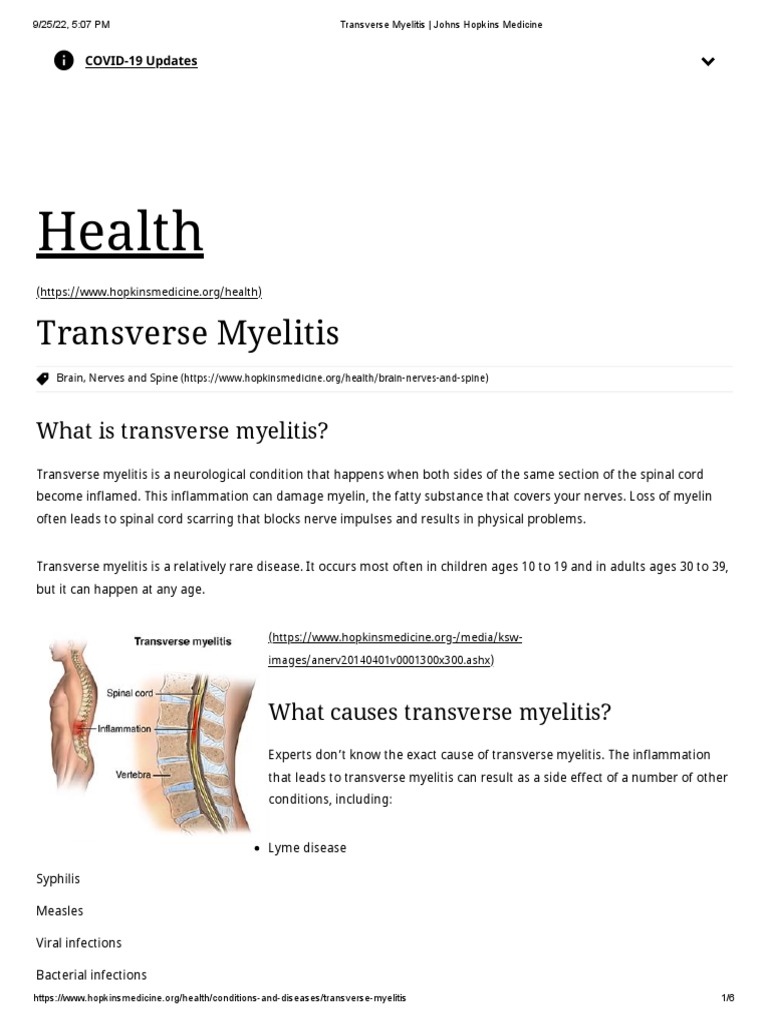 Transverse Myelitis Johns Hopkins Medicine PDF Epidemiology