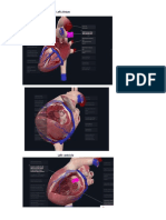 3D Views of Human Heart