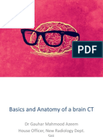 Basics of Brain CT Scan Interpretation