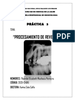 Procesamiento de Revelado