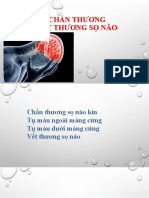 Chấn Thương Sọ Não