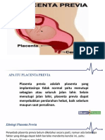 Presentasiku Placenta Previa