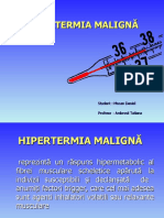 Hipertermia Maligna