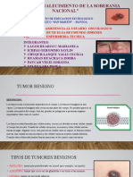 Tumor Benigno - Grupo 2