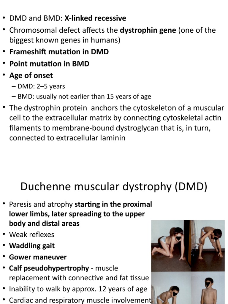 Duchenne and Becker | PDF