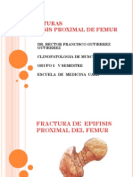Fractura Epifisis Proximal de Femur