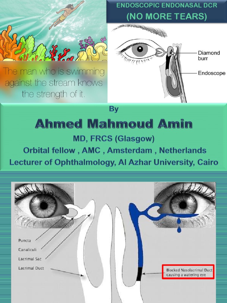 Endoscopic Endonasal DCR PDF Human Nose Anatomy