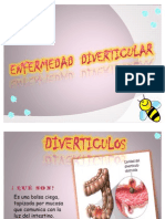 dIVERTICULOS