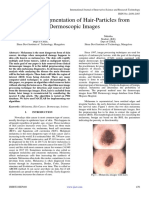 Digitally Segmentation of Hair-Particles From Dermoscopic Images