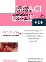 Exodoncia Compleja