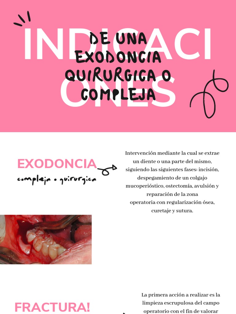 Exodoncia Compleja | PDF