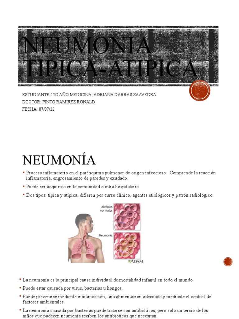 Neumonia Tipica Atipica | PDF | Neumonía | Causas de la muerte