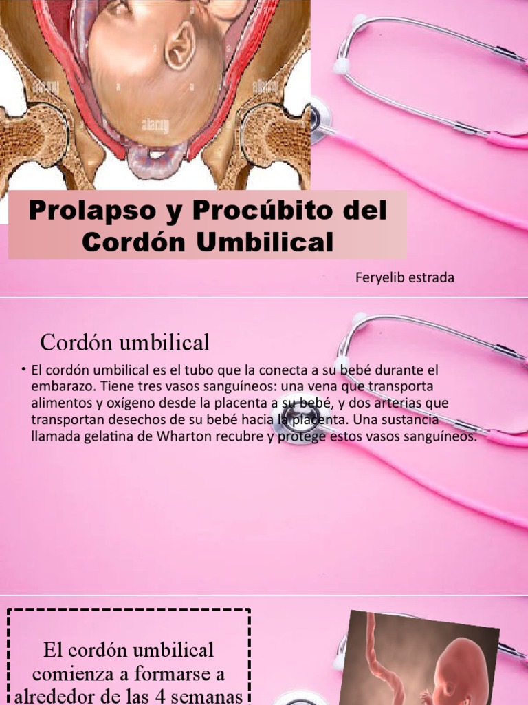Prolapso y Procubito de Cordon Umbilical PDF Placenta El embarazo