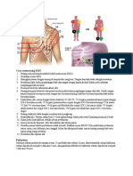 Cara Memasang EKG