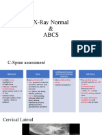 X Ray Normal