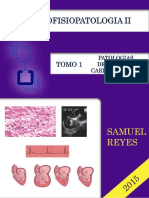 Fiebre Reumática: Causas, Síntomas y Tratamiento