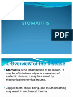 Stomatitis