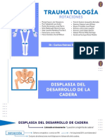 Sem 11 Exposición de Displasia de Cadera Enfermedad de Perthes Sinovitis Transitoria