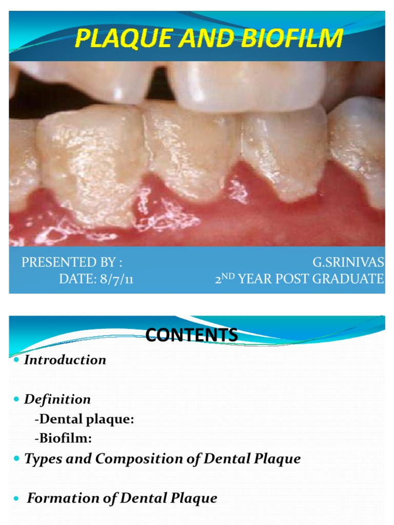 Plaque and Biofilm Biofilm Bacteria Free 30day Trial Scribd