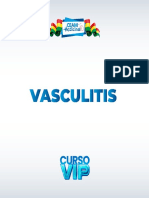 Vasculitis