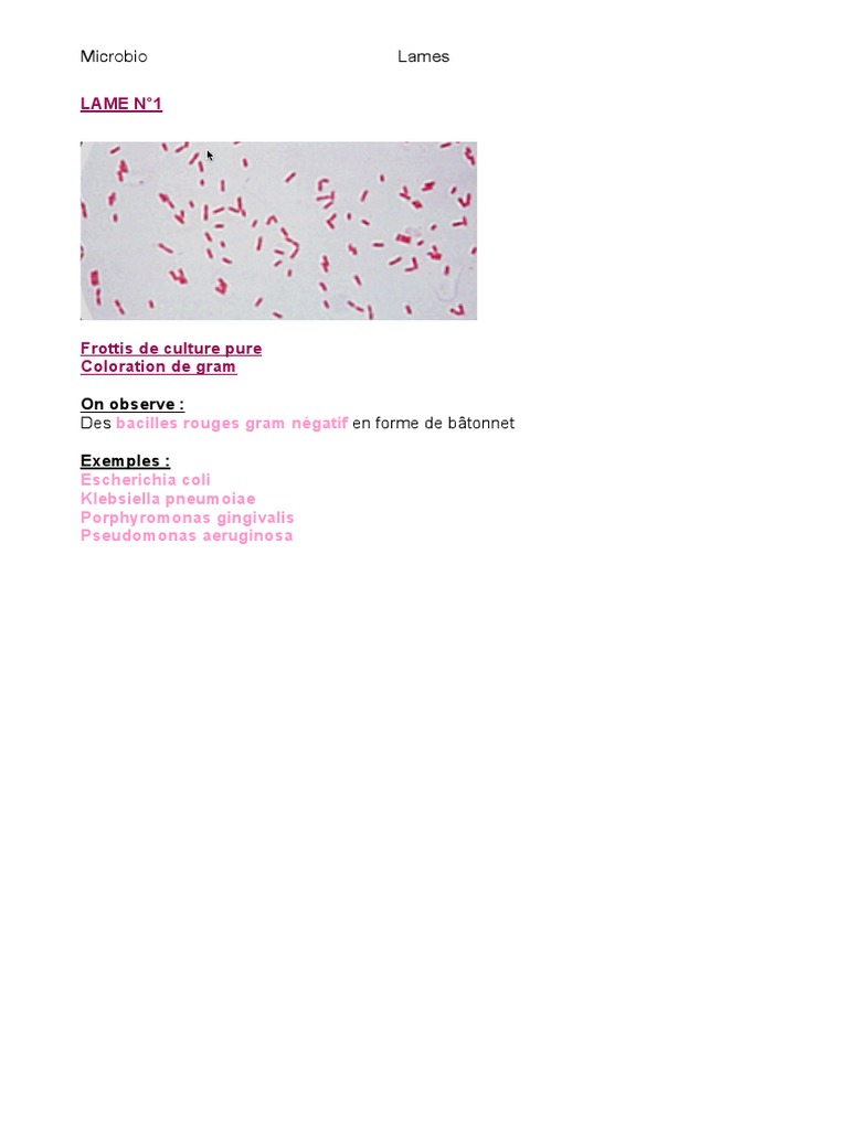 lames-microbio-pdf-streptocoque-microbiologie
