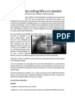 Semiología Radiográfica en Maxilar