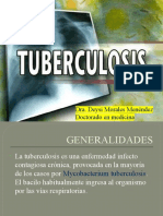Tuberculosis CHM