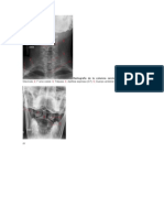 Radiografía de la columna cervical