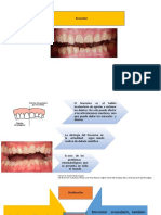 Presentación1 BRUXISMO 