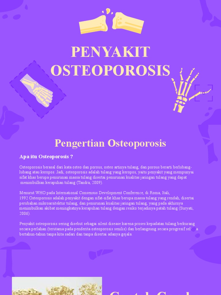 Osteoporosis PDF
