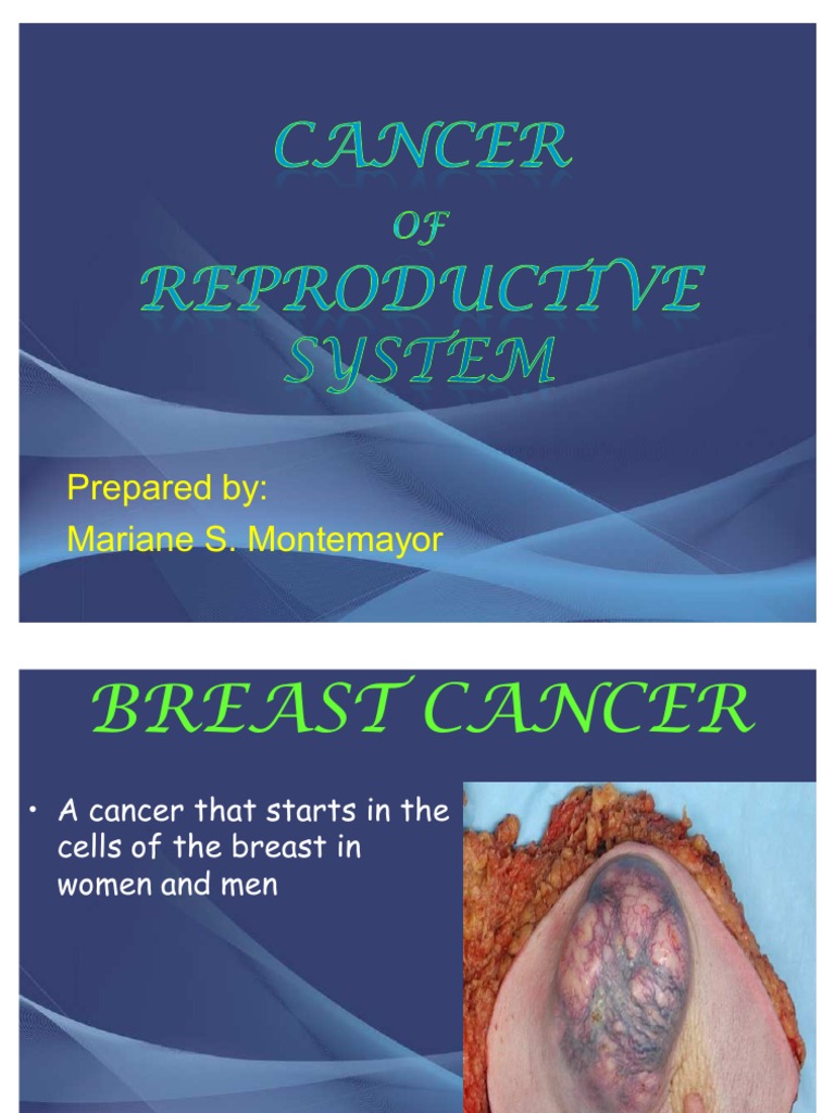 22161791 Cancer of Reproductive System Cervical Cancer Breast Cancer