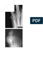 Arthritis Radiologi