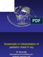 Systematic in Interpretation of Pediatric Chest X-Ray