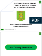 KD Casting Procedure