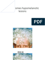 Review Hypomelanosis