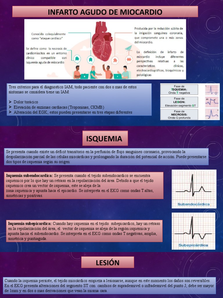 Diagnóstico de Infarto Agudo de Miocardio | PDF | Isquemia | Infarto de ...