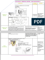 PETIT TOPO TUBERCULE DE MULLER  TUBERCULE GENTIAL  SINUS URO GENITAL