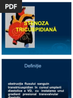 stenoza tricuspidiana