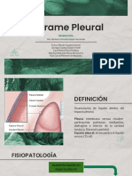 Derrame Pleural