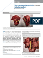 Uterine Rupture and Shock: An Unusual Presentation of Gestational Trophoblastic Neoplasm