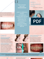 Oclusión Tipo Dentada