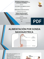 Alimentación Por Sonda Nasogastrica