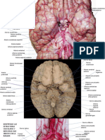 Estructuras vasculares y nerviosas del encéfalo
